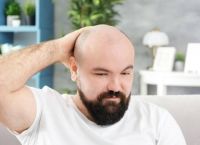 米诺地尔真的能治疗脱发吗（非那雄胺不可逆副作用）