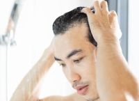 脂溢性脱发头顶有点秃怎么办？探索有效的治疗方法