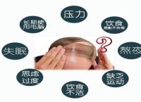 头疼脱发严重是什么原因引起的怎么治疗