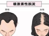 男士烫发后如何保养防止脱发