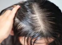 职业人怎么防止脱发？这些方法你必须知道！