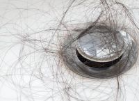 是什么原因引起男性的脱发