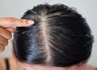 长期戴假发对身体有害吗？有优点也有缺点！