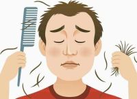 脱发严重一般是什么原因引起的？