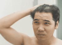40岁脂溢性脱发怎么办 - 有效应对脂溢性脱发的方法