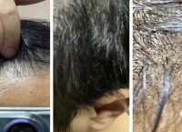如何防止脱发与头皮屑有关呢图片
