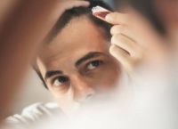 脱发厉害如何防止脱发？探索有效的预防和治疗方法