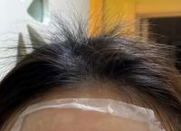 脱发和断发的原因及预防方法