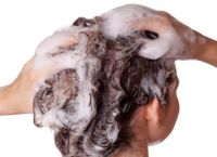 秃顶困扰：如何治疗和预防头发稀疏问题？