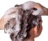 秃顶困扰：如何治疗和预防头发稀疏问题？