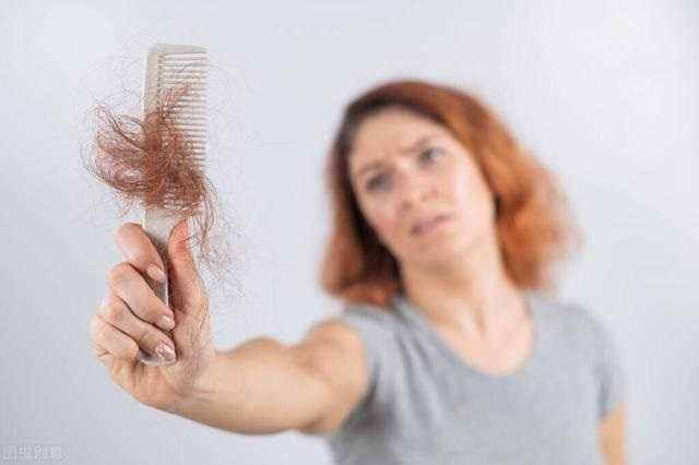 什么是脂溢性脱发？脂溢性脱发怎么治疗？