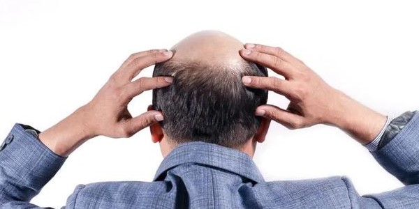10种头发护理误区有哪些