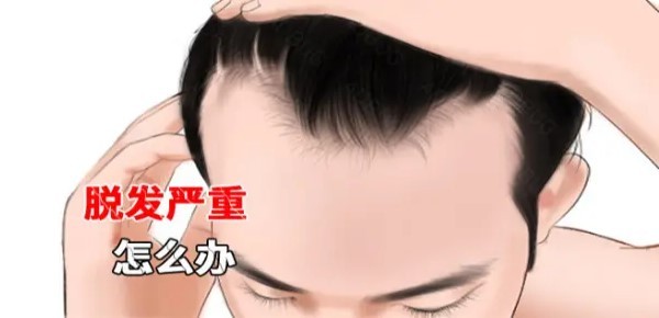 日常如何生发：有效的头发护理小技巧