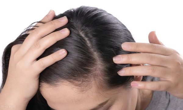 男性秃顶严重怎么办？探索有效的治疗方法和预防措施