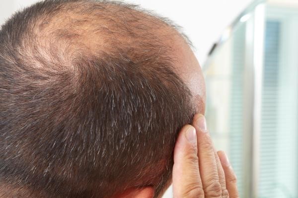 如何防止生理性脱发的发生原因有哪些？