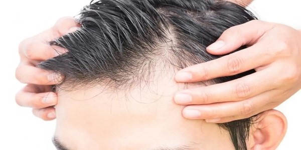 5个简单的方法帮助你改善头发稀疏的问题