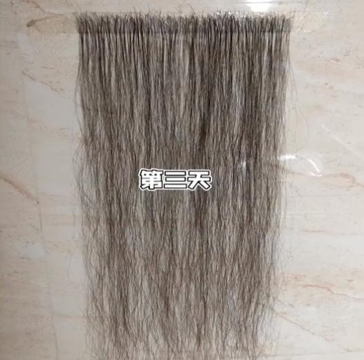 杭州卷发植发一般要多少钱