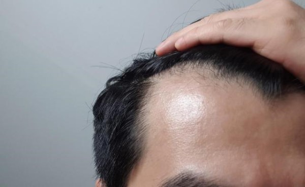 古代人如何防止脱发的方法有哪些