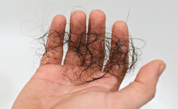 年轻人脱发可以治愈吗脂溢性脱发怎么办