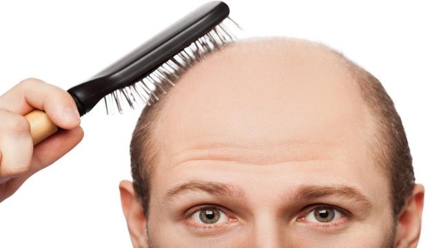 植发怎么防止脱发